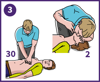 3 - Start hjertelungeredning